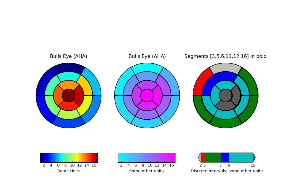 ../../_images/leftventricle_bulleye.png