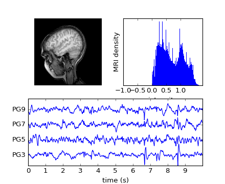 ../../_images/mri_with_eeg.png